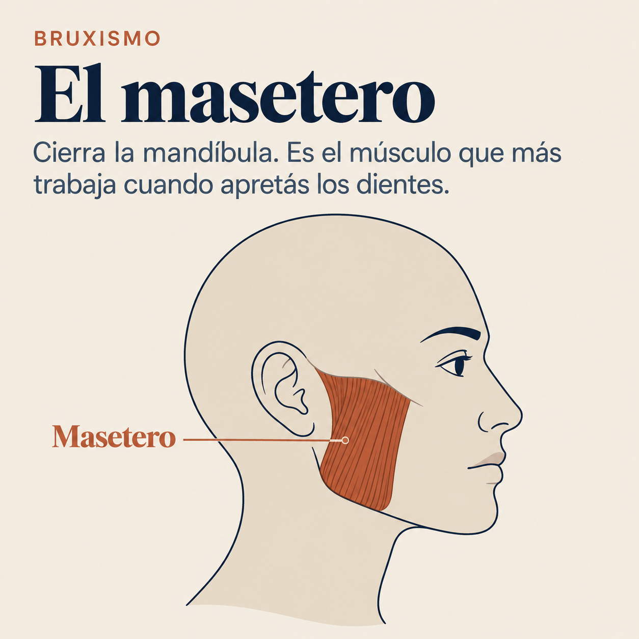 Ilustraci&oacute;n del m&uacute;sculo masetero en un perfil de rostro